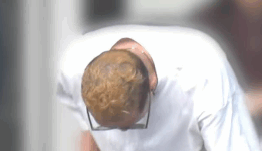 松岡昌宏がはげに見える原因を金髪照明カメラ角度から比較解説