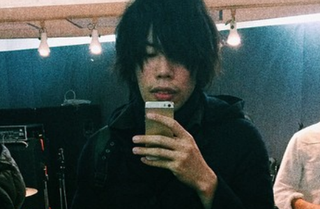 米津玄師の病気の噂と真相を整理。マルファン症候群まで徹底解説