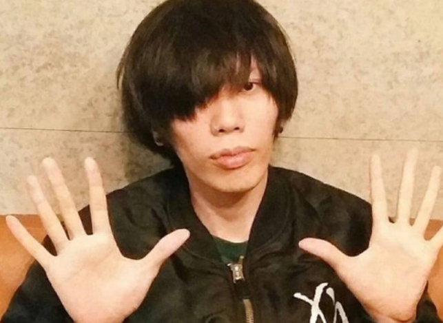 マルファン症候群と芸能人の特徴や見分け方を徹底解説
